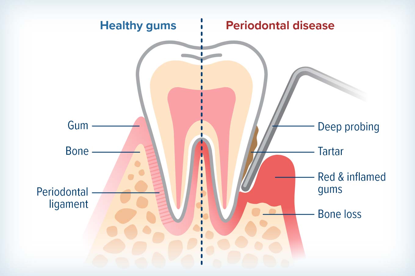 https://greenarbordental.com/wp-content/uploads/2024/12/difference-between-healthy-gums-and-periodontal-disease.jpg